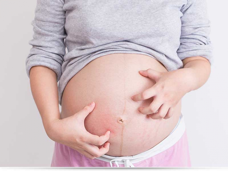 Чем мазать беременным живот от растяжек?